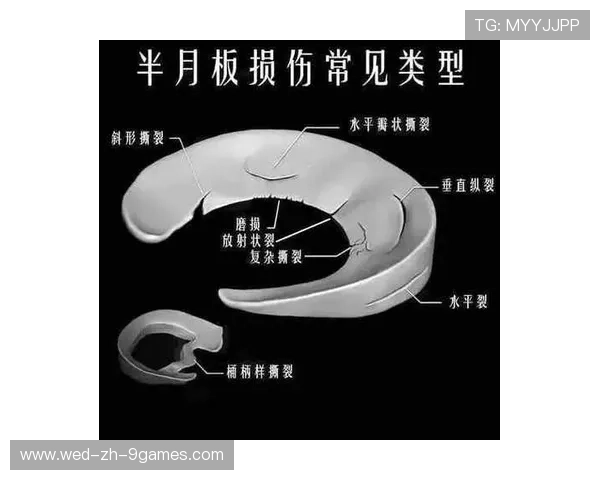 半月板损伤：切还是缝？手术后的康复之路，半月板损伤是手术好还是保守治疗好